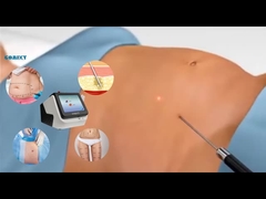 Equipamento Laser Lipo 30W 60W 980nm Diodo Lipo Máquina Laser Para Perda de Peso