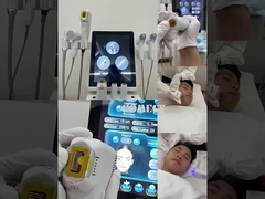 12d hifu + vmax + M8 + Ice Hammer 4 em 1